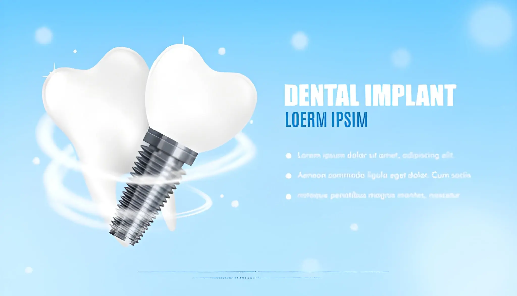 Dental Implants Cairns Your Complete Local Guide